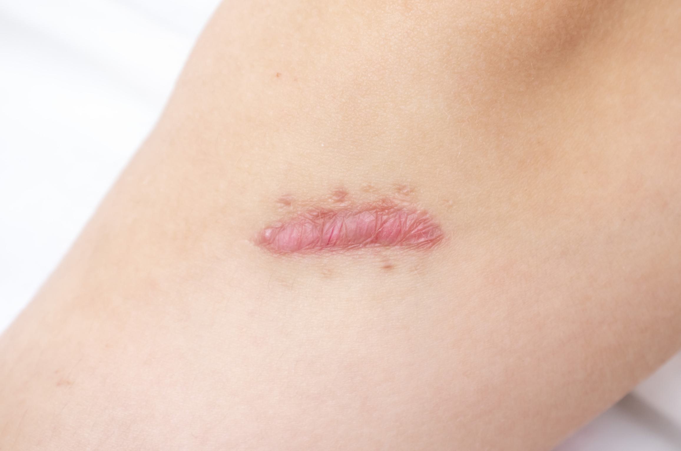 Dr. Shirisha Skin, Hair & Laser Clinic